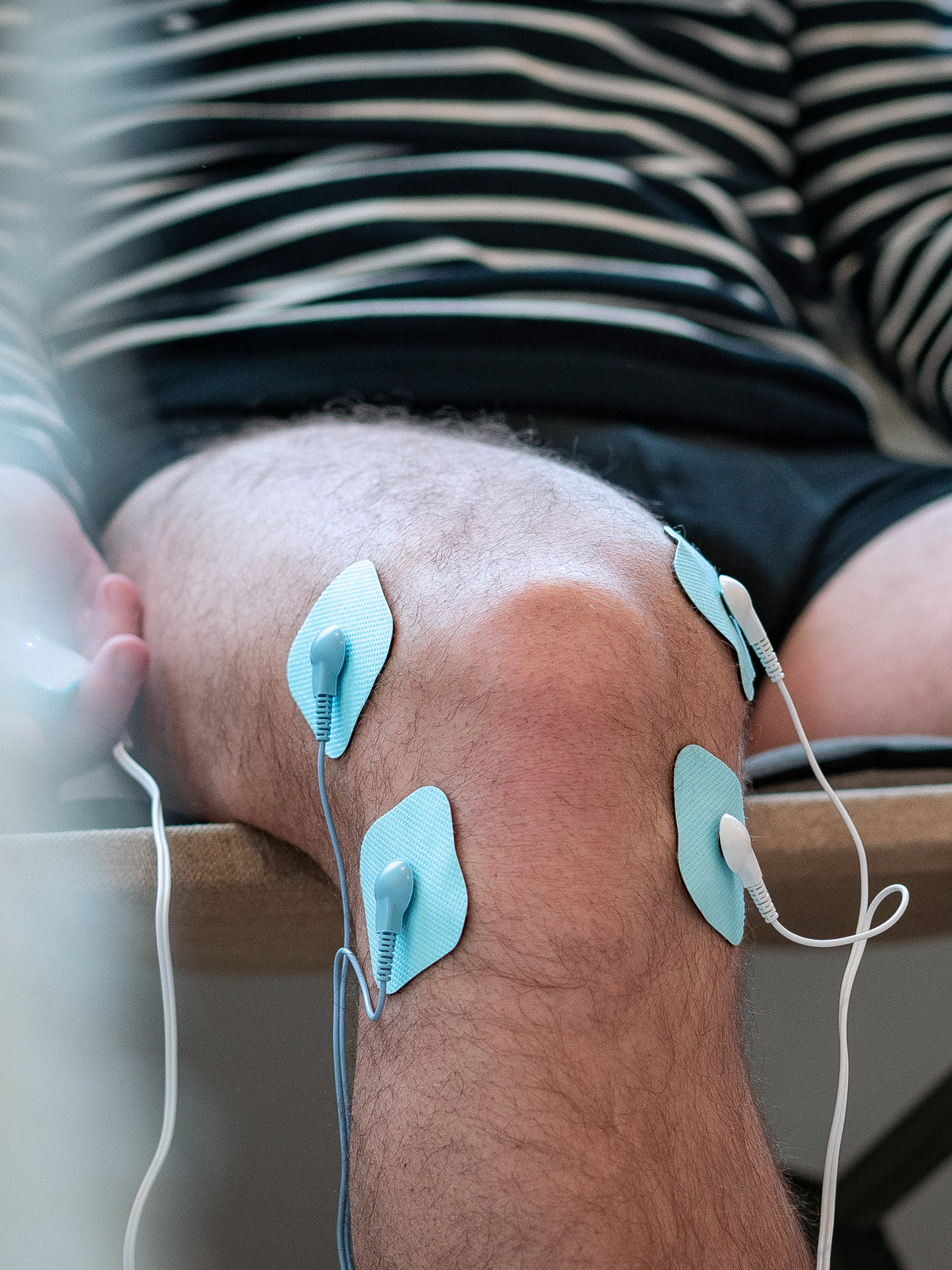 Bluetens Electrodes S12